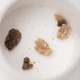 Kidney stones: The bigger they are, they harder—and more excruciatingly painful—they are to pass. (Image: G.L. Kohuth, Michigan State University)